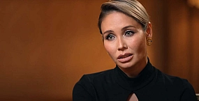 Ляйсан Утяшева сообщила об аллергической реакции после укуса осы на съемках шоу