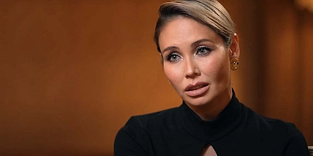 Ляйсан Утяшева сообщила об аллергической реакции после укуса осы на съемках шоу