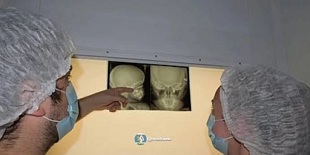 В Свердловской области врачи спасли глаз двухлетнему мальчику после травмы саморезом